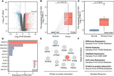 COL10A1 allows stratification of invasiveness of colon cancer and associates to extracellular matrix and immune cell enrichment in the tumor parenchyma